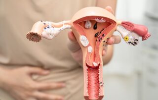 uterine fibroids